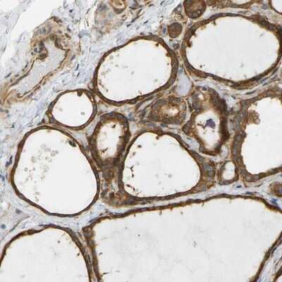 Immunohistochemistry-Paraffin: Cytohesin 3 Antibody [NBP1-90097] - Staining of human thyroid gland shows moderate cytoplasmic positivity in glandular cells.