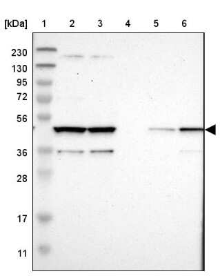 Western Blot: Cytohesin 3 Antibody [NBP1-90097] - Lane 1: Marker  [kDa] 230, 130, 95, 72, 56, 36, 28, 17, 11.  Lane 2: Human cell line RT-4.  Lane 3: Human cell line U-251MG sp.  Lane 4: Human plasma (IgG/HSA depleted).  Lane 5: Human liver tissue.  Lane 6: Human tonsil tissue