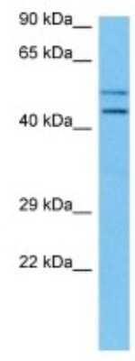 Western Blot: Cytohesin 3 Antibody [NBP3-10863] - Western blot analysis of Cytohesin 3 in Human HepG2 Whole Cell lysates. Antibody dilution at 1ug/ml