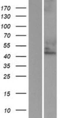 Western Blot: Cytohesin 3 Overexpression Lysate (Adult Normal) [NBP2-10577] Left-Empty vector transfected control cell lysate (HEK293 cell lysate); Right -Over-expression Lysate for Cytohesin 3.