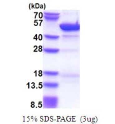 SDS-Page: Cytohesin 3 Recombinant Protein [NBP2-51671] - 15% SDS Page (3 ug)