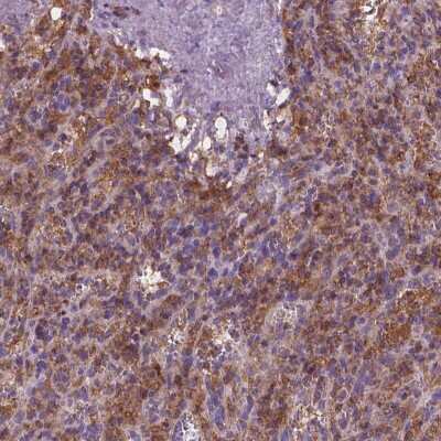 Immunohistochemistry: Cytohesin 4 Antibody [NBP2-49664] - Staining of human spleen shows cytoplasmic positivity in lymphoid cells.