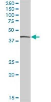 Western Blot: Cytohesin 4 Antibody [H00027128-B01P] - Analysis of PSCD4 expression in human spleen.