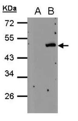Western Blot: Cytohesin 4 Antibody [NBP2-19974] - Analysis of Cytohesin 4 expression in transfected 293T cell line by PSCD4 polyclonal antibody. A: Non-transfected lysate. B: Cytohesin 4 transfected lysate. 12% SDS PAGE gel, diluted at 1:500.