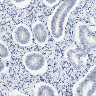 Immunohistochemistry-Paraffin: Cytokeratin, HMW Antibody [NBP1-81648] - Staining of human endometrium shows no positivity in glandular cells as expected.