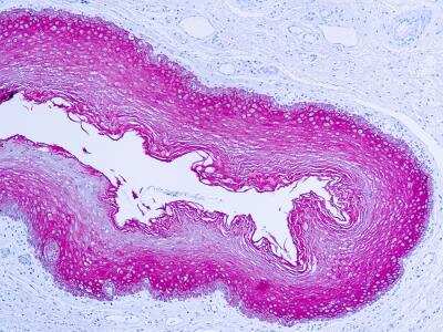 Immunohistochemistry-Paraffin: Cytokeratin, pan Antibody [NBP1-22909] - FFPE human skin stained with Cytokeratin Wide Spectrum antibody (NBP1-22909).