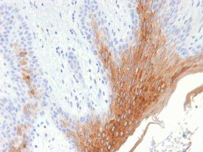 Immunohistochemistry-Paraffin: Cytokeratin 1/10 Antibody (KRT10/1990R) - Azide and BSA Free [NBP2-75768] - Formalin-fixed, paraffin-embedded human Skin stained with Cytokeratin 10 Rabbit Recombinant Monoclonal Antibody (KRT10/1990R).