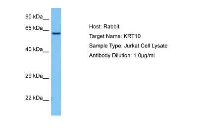 Western Blot: Cytokeratin 1/10 Antibody [NBP2-86612] - Host: Rabbit. Target Name: KRT10. Sample Tissue: Human Jurkat Whole Cell lysates. Antibody Dilution: 1ug/ml