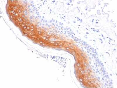 Immunohistochemistry-Paraffin: Cytokeratin 1 Antibody (KRT1/1840) - Azide and BSA Free [NBP3-08475] - Formalin-fixed, paraffin-embedded human Skin stained with Cytokeratin 1 Mouse Monoclonal Antibody (KRT1/1840).