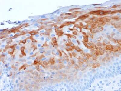 Immunohistochemistry-Paraffin: Cytokeratin 1 Antibody (LHK1) - Azide and BSA Free [NBP3-08474] - Formalin-fixed, paraffin-embedded human Cervix stained with Cytokeratin 1 Mouse Monoclonal Antibody (LHK1).
