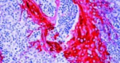 Immunohistochemistry: Cytokeratin 10/13 Antibody (DE-K13) [NBP1-22538] - IHC analysis of Cytokeratin 10/13 formalin-fixed paraffin embedded human tonsil using NBP1-22538.