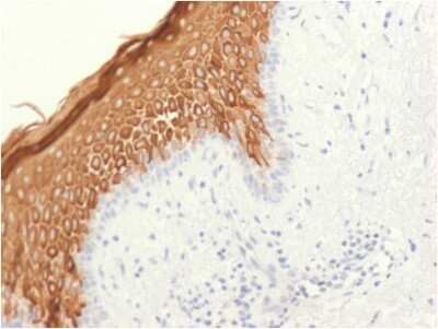 Immunohistochemistry-Paraffin: Cytokeratin 10 Antibody (KRT10/1948R) [NBP3-07828] - Formalin-fixed, paraffin-embedded human skin stained with Cytokeratin 10 Rabbit Recombinant Monoclonal Antibody (KRT10/1948R).