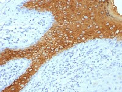 Immunohistochemistry-Paraffin: Cytokeratin 10 Antibody (KRT10/844 + KRT10/1275) - Azide and BSA Free [NBP2-54327] - Formalin-fixed, paraffin-embedded human Skin stained with Cytokeratin 10 Monoclonal Antibody (KRT10/+ KRT10/1275).