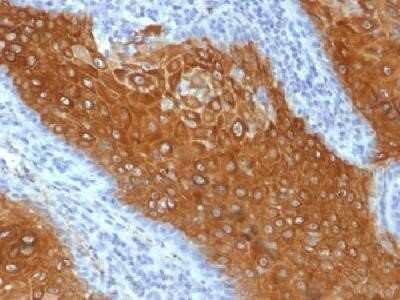 Immunohistochemistry-Paraffin: Cytokeratin 10 Antibody (KRT10/844) - Azide and BSA Free [NBP2-47825] - Formalin-fixed, paraffin-embedded human skin stained with cytokeratin 10 Monoclonal Antibody (KRT10/844).