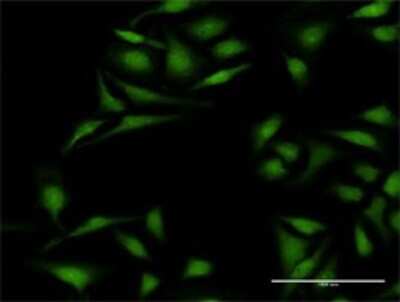 Immunocytochemistry/Immunofluorescence: Cytokeratin 12 Antibody [H00003859-D01P] - Analysis of antibody to KRT12 on HeLa cell. Antibody concentration 20 ug/ml.