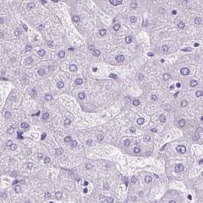 Immunohistochemistry-Paraffin: Cytokeratin 12 Antibody [NBP2-58256] - Staining of human liver.