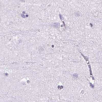 Immunohistochemistry-Paraffin: Cytokeratin 12 Antibody [NBP2-58256] - Staining of human cerebral cortex.