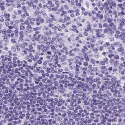 Immunohistochemistry-Paraffin: Cytokeratin 12 Antibody [NBP2-58256] - Staining of human lymph node.