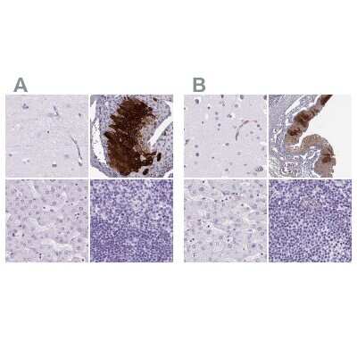 Immunohistochemistry-Paraffin: Cytokeratin 12 Antibody [NBP2-58256] - Staining of human cerebral cortex, eye, liver and lymph node using Anti-Cytokeratin 12 antibody NBP2-58256 (A) shows similar protein distribution across tissues to independent antibody NBP2-58100 (B).