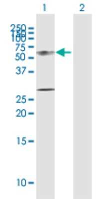 Western Blot: Cytokeratin 12 Antibody [H00003859-D01P] - Analysis of KRT12 expression in transfected 293T cell line by KRT12 polyclonal antibody.Lane 1: KRT12 transfected lysate(54.34 KDa).Lane 2: Non-transfected lysate.