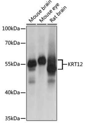 Western Blot: Cytokeratin 12 Antibody [NBP2-92582] - Analysis of extracts of various cell lines, using Cytokeratin 12 at 1:1000 dilution.Secondary antibody: HRP Goat Anti-Rabbit IgG (H+L) at 1:10000 dilution.Lysates/proteins: 25ug per lane.Blocking buffer: 3% nonfat dry milk in TBST.Detection: ECL Basic Kit .Exposure time: 1s.