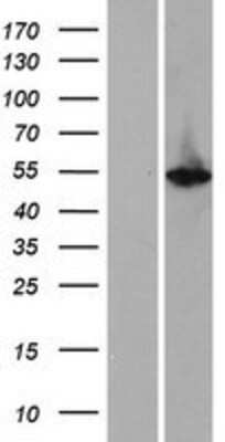 Western Blot: Cytokeratin 12 Overexpression Lysate (Adult Normal) [NBP2-09047] Left-Empty vector transfected control cell lysate (HEK293 cell lysate); Right -Over-expression Lysate for Cytokeratin 12.