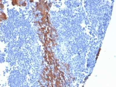 Immunohistochemistry-Paraffin: Cytokeratin 13 Antibody (KRT13/2659) - Azide and BSA Free [NBP3-08284] - Formalin-fixed, paraffin-embedded human Tonsil stained with Cytokeratin 13 Mouse Monoclonal Antibody (KRT13/2659).