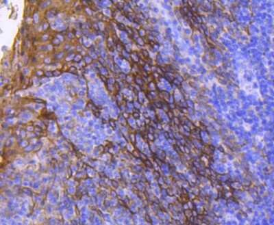 Immunohistochemistry-Paraffin: Cytokeratin 13 Antibody (SN71-09) [NBP2-67689] - Analysis of paraffin-embedded human tonsil tissue using anti-Cytokeratin 13 antibody. Counter stained with hematoxylin.