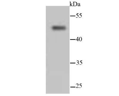 Western Blot: Cytokeratin 13 Antibody (SN71-09) [NBP2-67689] - Analysis of Cytokeratin 13 hybrid fish (crucian-carp) brain tissue lysate using anti-Cytokeratin 13 antibody at 1/500 dilution.