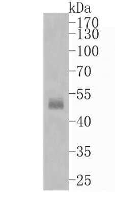 Western Blot: Cytokeratin 13 Antibody (SN71-09) [NBP2-67689] - Analysis of Cytokeratin 13 on human lung tissue lysates. Proteins were transferred to a PVDF membrane and blocked with 5% BSA in PBS for 1 hour at room temperature. The primary antibody (1/500) was used in 5% BSA at room temperature for 2 hours. Goat Anti-Rabbit IgG - HRP Secondary Antibody at 1:5,000 dilution was used for 1 hour at room temperature.