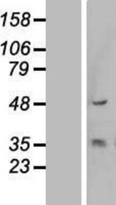 Western Blot Cytokeratin 13 Overexpression Lysate