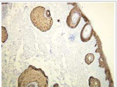 Immunohistochemistry-Paraffin: Cytokeratin 14 Antibody (D19-N) [NBP1-79069] - CK14 expression in the epidermal and skin-adnexal epithelial cells. All, formalin fixed, paraffin embedded human tissues (4 um sections) stained with anti-Cytokeratin 14 monospecific clonal antibody.
