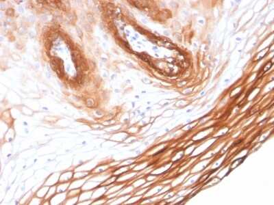 Immunohistochemistry-Paraffin: Cytokeratin 14 Antibody (KRT14/2375) - Azide and BSA Free [NBP3-08531] - Formalin-fixed, paraffin-embedded human Skin stained with Cytokeratin 14 Mouse Monoclonal Antibody (KRT14/2375).