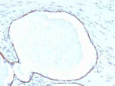 Immunohistochemistry-Paraffin: Cytokeratin 14 Antibody (KRT14/4132) [NBP3-07849] - Formalin-fixed, paraffin-embedded human prostate stained with Cytokeratin 14 Mouse Monoclonal Antibody (KRT14/4132).