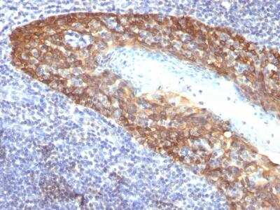 Immunohistochemistry-Paraffin: Cytokeratin 14 Antibody (KRT14/532) - IHC-Prediluted [NBP2-48042] - Formalin-fixed, paraffin-embedded human Tonsil stained with Cytokeratin 14 Monoclonal Antibody (KRT14/532).