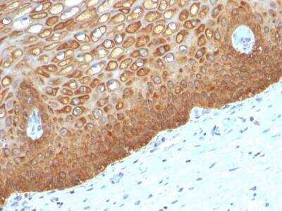 Immunohistochemistry-Paraffin: Cytokeratin 14 Antibody (KRT14/532) - IHC-Prediluted [NBP2-48042] - Formalin-fixed, paraffin-embedded human Cervix stained with Cytokeratin 14 Monoclonal Antibody (KRT14/532).