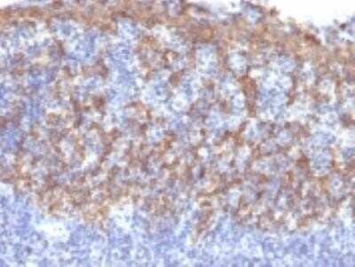 Immunohistochemistry-Paraffin: Cytokeratin 14 Antibody (LL002) - Azide and BSA Free [NBP2-34675] - Formalin-fixed, paraffin-embedded human Prostate stained with Cytokeratin 14 Monoclonal Antibody (LL002)