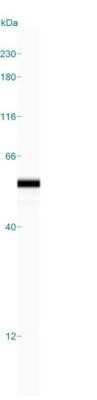 Simple Western: Cytokeratin 14 Antibody (LL002) - Azide and BSA Free [NBP2-34675] - Simple Western lane view shows a specific band for Cytokeratin 14 in 0.2 mg/ml of A431 lysate(s). This experiment was performed under reducing conditions using the 12-230 kDa separation system.