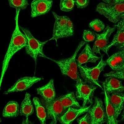 Immunocytochemistry/Immunofluorescence: Cytokeratin 14 Antibody (SPM263) - Azide and BSA Free [NBP2-34403] - Immunofluorescence Analysis of A549 cells labeling KRT14 with Cytokeratin 14 Antibody (SPM263) followed by Goat anti-Mouse IgG-CF488 (Green). The nuclear counterstain is Red Dot (Red).