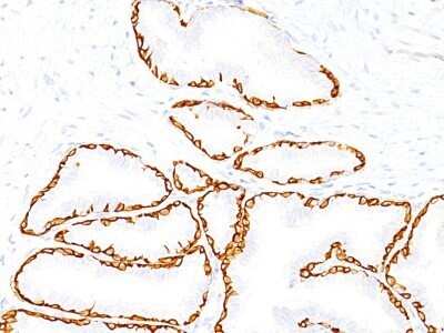 Immunohistochemistry-Paraffin: Cytokeratin 14 Antibody (SPM263) - Azide and BSA Free [NBP2-34403] - Formalin-paraffin prostate (20X) stained with Cytokeratin 14 MAb (SPM263).