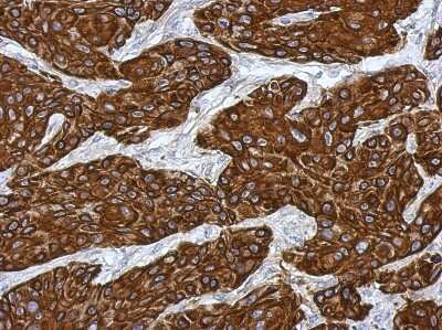 Immunohistochemistry-Paraffin: Cytokeratin 15 Antibody [NBP2-16088] - Immunohistochemical analysis of paraffin-embedded Cal27 xenograft, using antibody at 1:500 dilution.