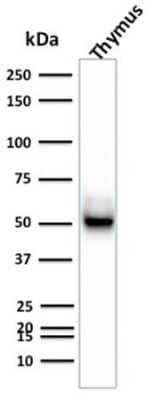 Western Blot: Cytokeratin 15 Antibody (KRT15/2957) - Azide and BSA Free [NBP3-08478] - Western Blot Analysis of Human Thymus tissue lysate using Cytokeratin 15 Mouse Monoclonal Antibody (KRT15/2957)