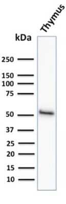 Western Blot: Cytokeratin 15 Antibody (KRT15/2958) [NBP3-07614] - Western Blot Analysis of human Thymus tissue lysate using Cytokeratin 15 Mouse Monoclonal Antibody (KRT15/2958)