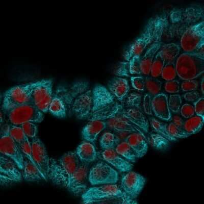 Immunocytochemistry/Immunofluorescence: Cytokeratin 15 Antibody (KRT15/2959) - Azide and BSA Free [NBP3-08599] - Confocal immunofluorescence image of MCF-7 cells using Cytokeratin 15 Mouse Monoclonal Antibody (KRT15/2959) followed by goat anti- Mouse CF488 (Cyan) and RedDot is used to label the nuclei Red.