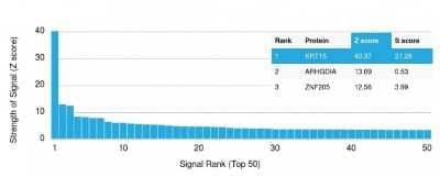 Protein Array: Cytokeratin 15 Antibody (KRT15/2959) - Azide and BSA Free [NBP3-08599] - Analysis of Protein Array containing more than 19,000 full-length human proteins using Cytokeratin 15 Mouse Monoclonal Antibody (KRT15/2959).
