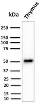 Western Blot: Cytokeratin 15 Antibody (KRT15/2959) - Azide and BSA Free [NBP3-08599] - Western Blot Analysis of Human Thymus tissue lysate using Cytokeratin 15 Mouse Monoclonal Antibody (KRT15/2959)