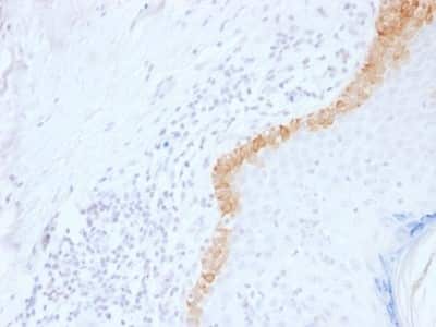 Immunohistochemistry-Paraffin: Cytokeratin 15 Antibody (LHK15) [NBP2-53308] - Formalin-fixed, paraffin-embedded human Skin Stained with Cytokeratin 15 Monoclonal Antibody (LHK15).