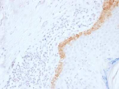 Immunohistochemistry-Paraffin: Cytokeratin 15 Antibody (LHK15) [NBP2-54462] - Formalin-fixed, paraffin-embedded human Skin Stained with Cytokeratin 15 Monoclonal Antibody (LHK15).