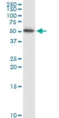 Western Blot: Cytokeratin 15 Antibody [H00003866-D01P] - Analysis of KRT15 expression in A-431.
