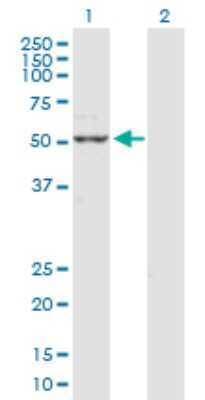 Western Blot: Cytokeratin 15 Antibody [H00003866-D01P] - Analysis of KRT15 expression in transfected 293T cell line by KRT15 polyclonal antibody.Lane 1: KRT15 transfected lysate(49.20 KDa).Lane 2: Non-transfected lysate.